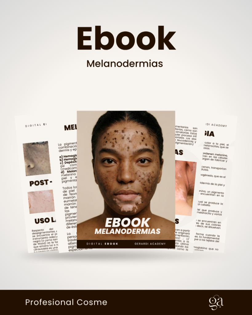 EBOOK EN MELANODERMIAS